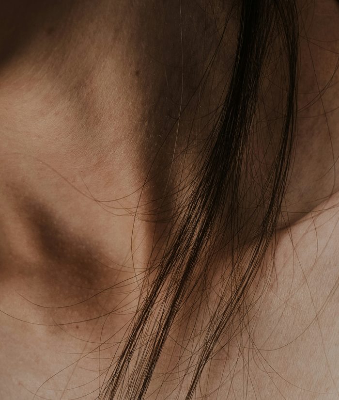 FemaleHiarLoss-3 FemaleHiarLoss-3