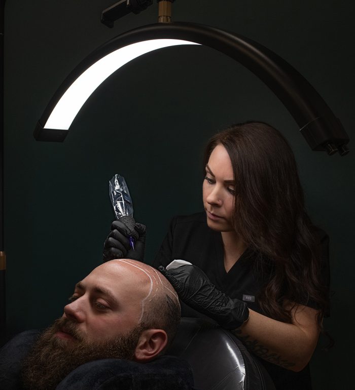 MaleHairLoss-Image2 MaleHairLoss-Image2