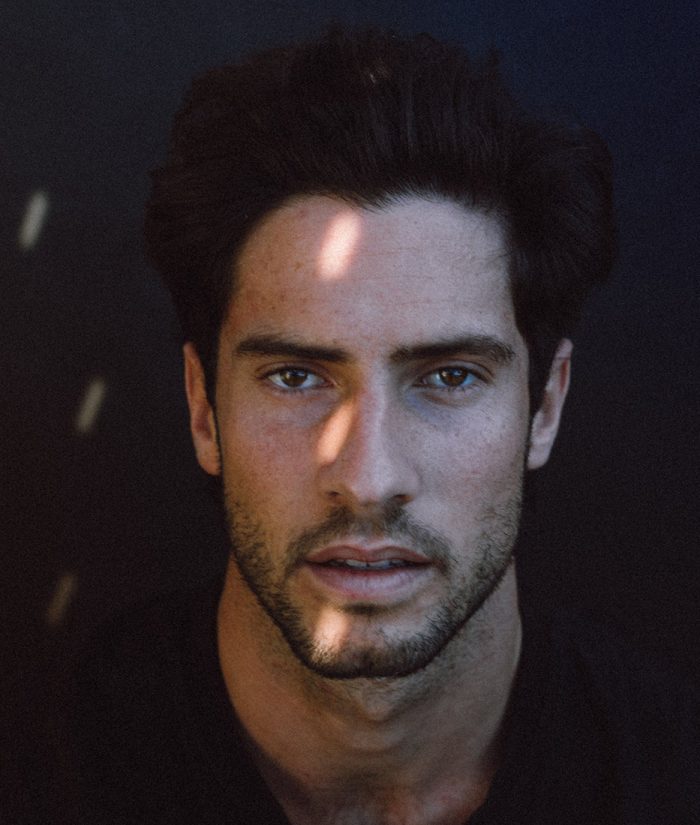 MaleHairLoss2 MaleHairLoss2